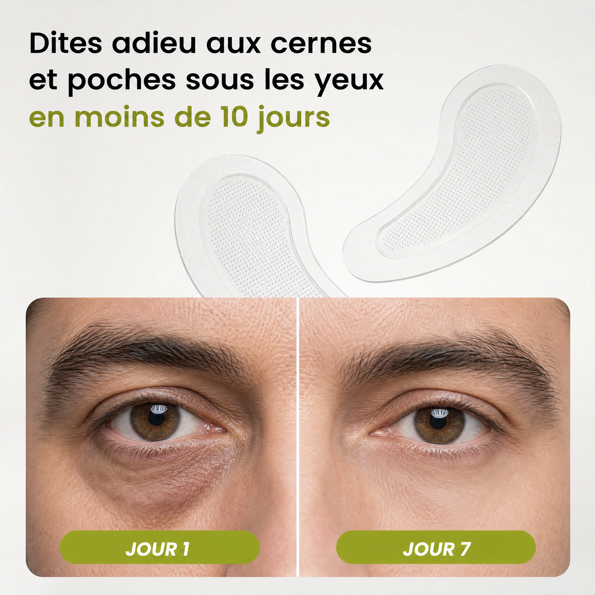 Patchs Microneedle | Nouvelle Génération